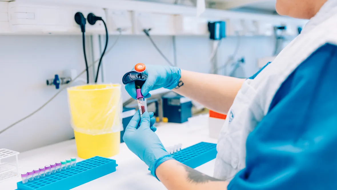 Person med blå gummihandskar håller i pipett och provrör med blod.