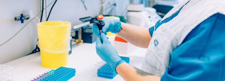 Kvinna pipetterar blod för vidare analys i ett instrument.