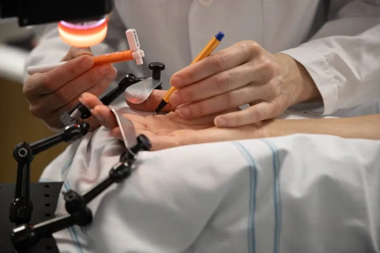 Studiedeltagares hand testas med en tunn nål.