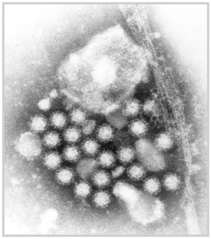 Noro virus.