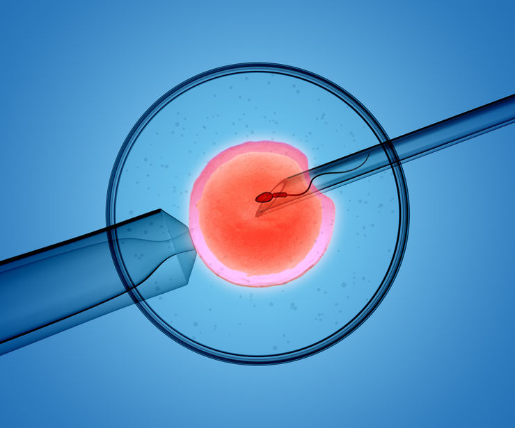 Sperm is injected directly into an egg