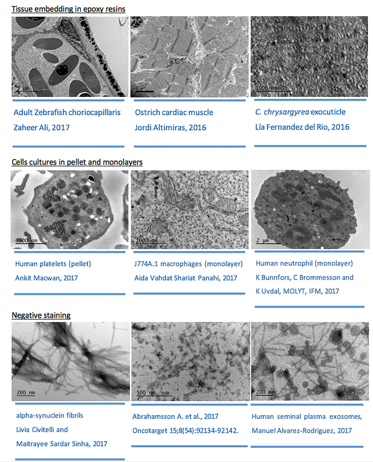 Examples of EM images