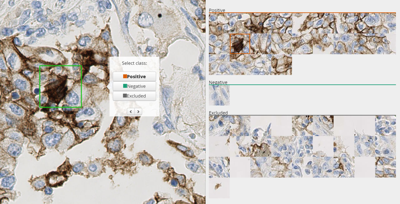 En prototyp för att diagnosticera en tumör 