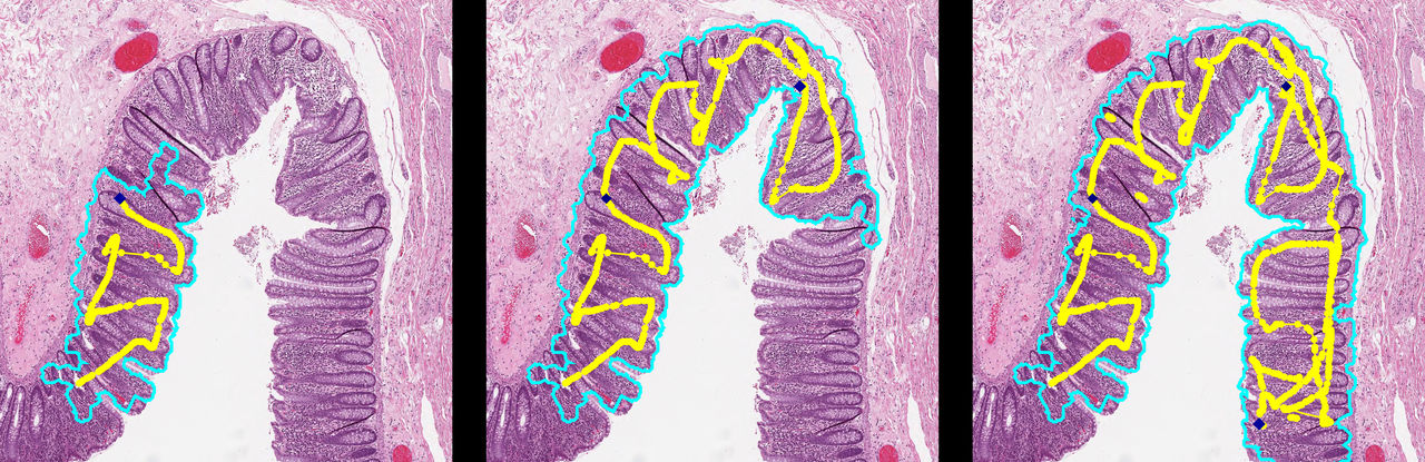 Träning av ett maskininlärningssystem