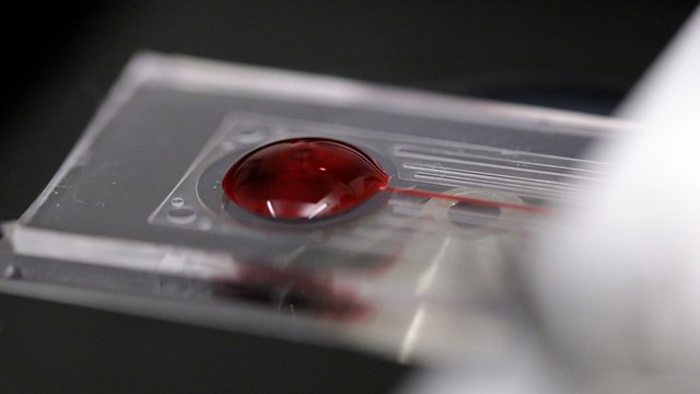 bloddroppe i mikroskop med rött ljus