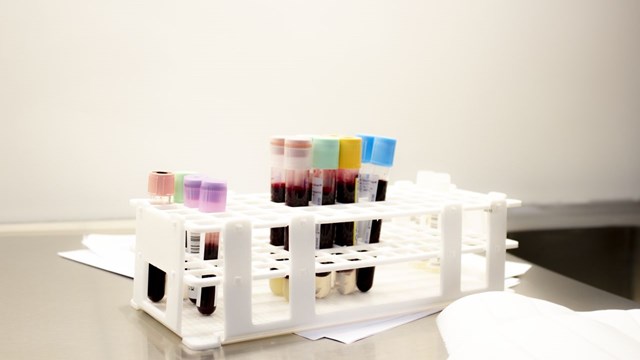 Rack of blood samples