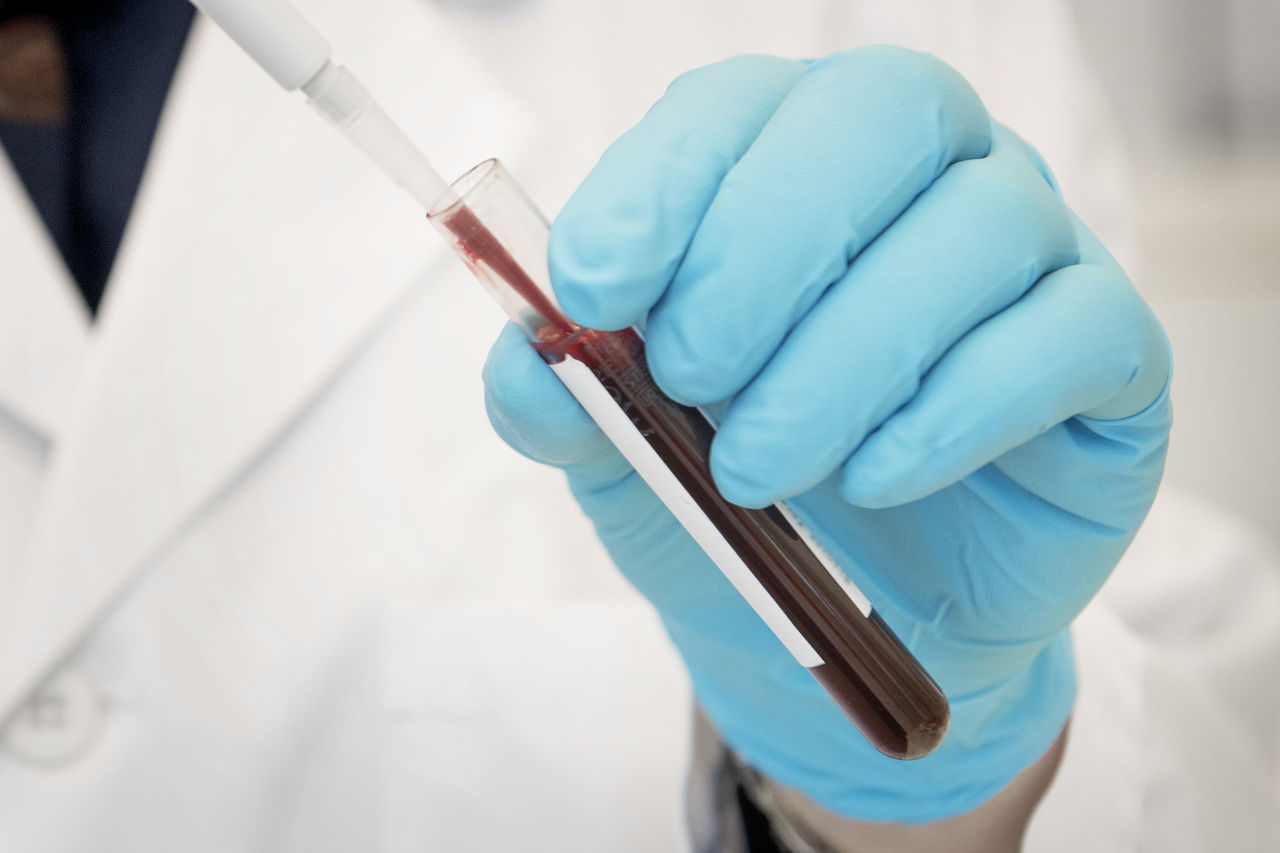 ett provrör med blod.