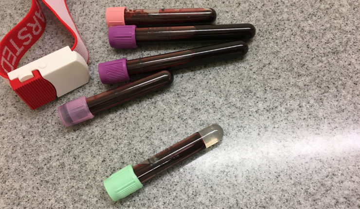 Lab tubes with blood