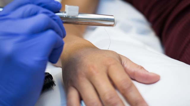forskare trycker med en mycket tunn tråd på handen för att mäta egenskaper hos nervceller i huden