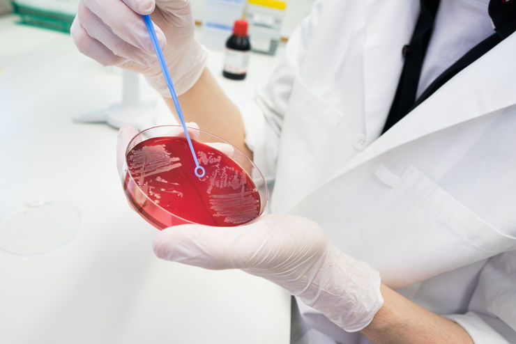 researcher with bacteria grown on plate