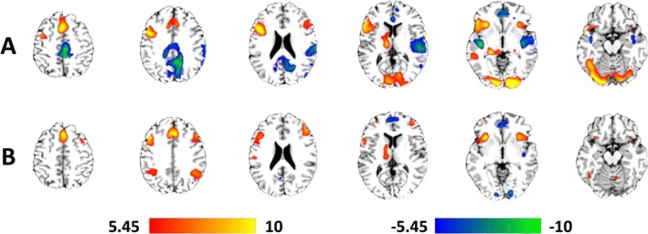 Functional MRI of the brain