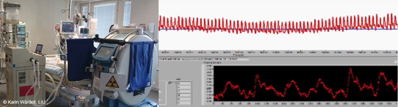 Neuro intensive care instruments