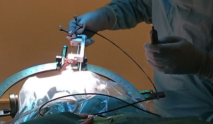 Optical guidance in neuro surgery