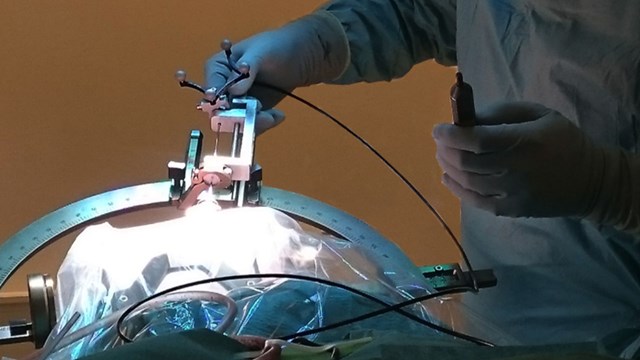 Optical guidance in neuro surgery