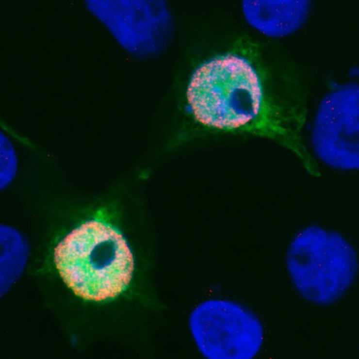 [Figure caption: Interaction of transcription factor FOXB2 (red) with beta-catenin (green) in epithelial cells.]