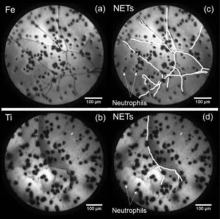 Energy-filtered PEEM images of neutrophils deposited on iron oxide (a) and titanium oxide (b) nanostructured surfaces acquired at E-EF = 4.0 eV, showing NETs formation. Highlighted representation of NETs formation on iron oxide (c) and titanium oxide (d) nanostructured surfaces