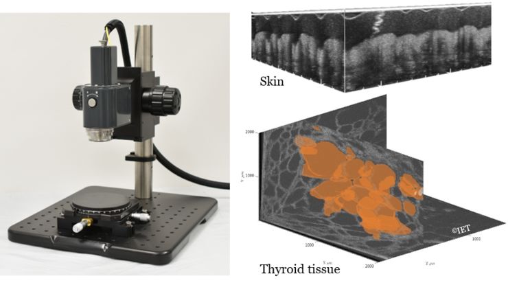 Bild på ett mikroskop och två digitala bilder på hud sedda i mikroskop.