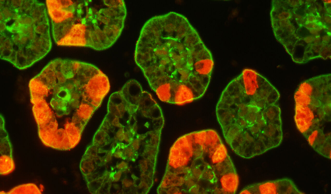 Fig 2   Immunohistochemistry of rotavirus infected duodenum of mice.  Red shows  rotavirus infected cells and green activated enteric glia cells.