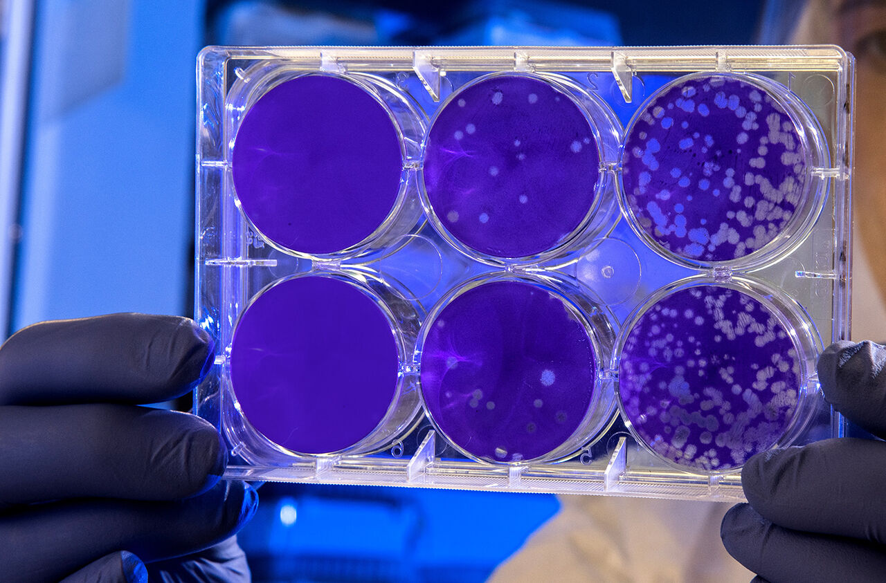 Molekylär medicin och virologi.