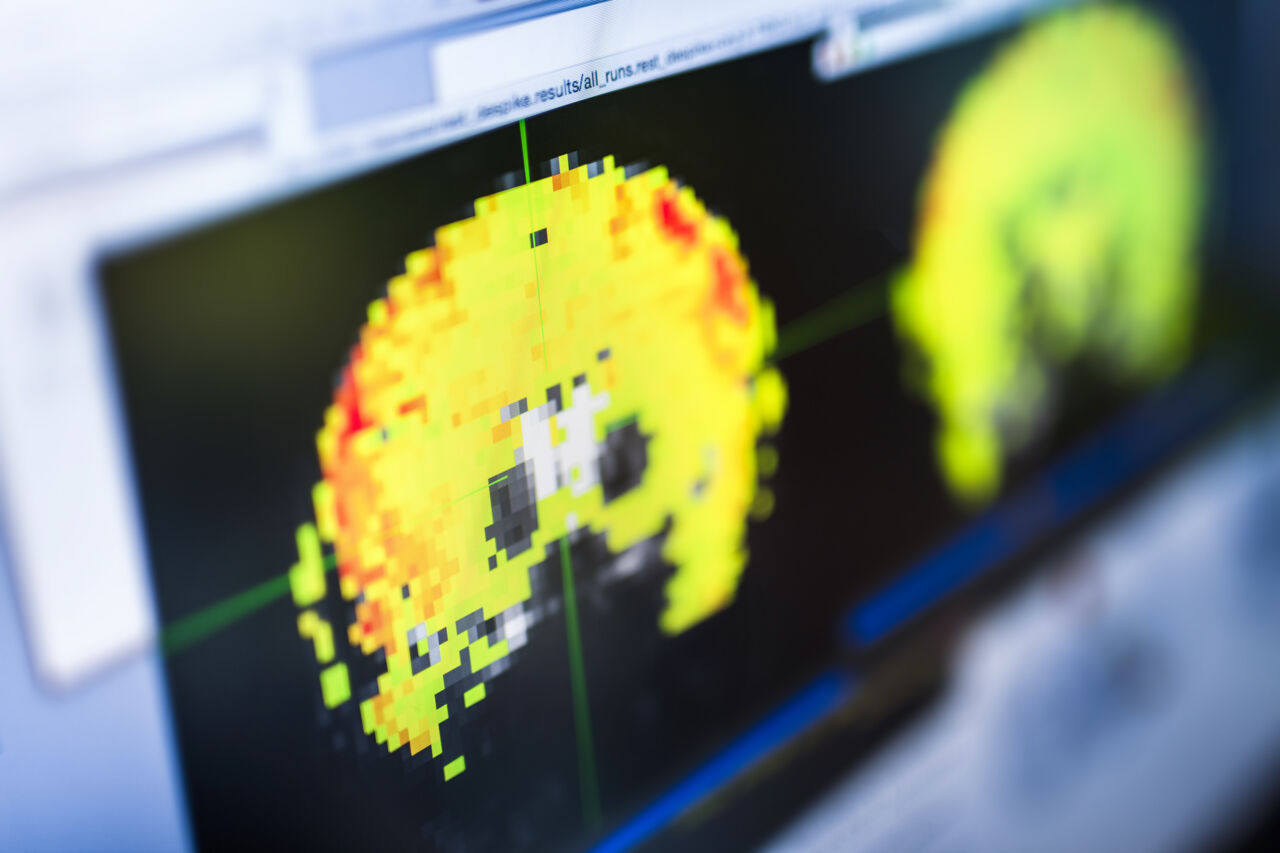 Datorskärm som visar studie från Heiligs labb.