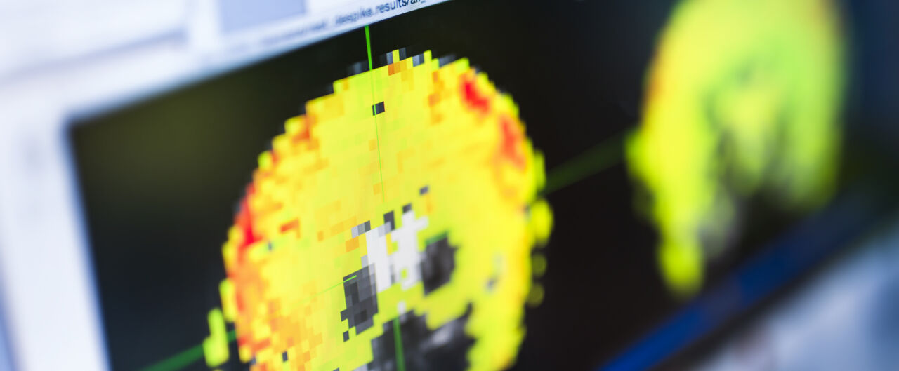 Datorskärm som visar studie från Heiligs labb.