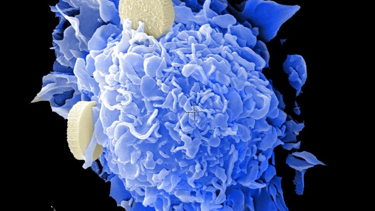 Puffbild för forskargruppen som forskar om blodstamceller och leukemi.