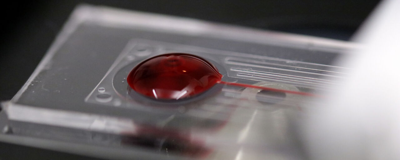 bloddroppe i mikroskop med rött ljus