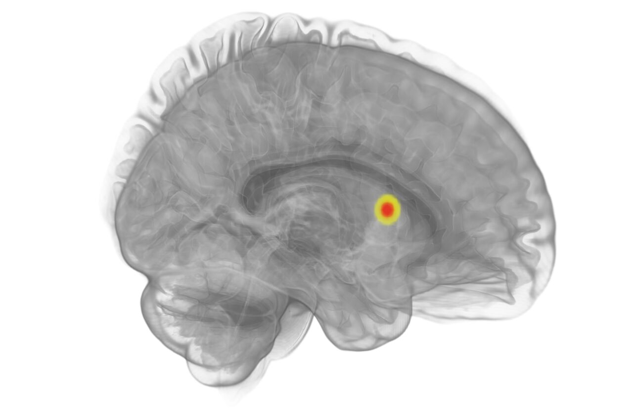 A scan of a human brain