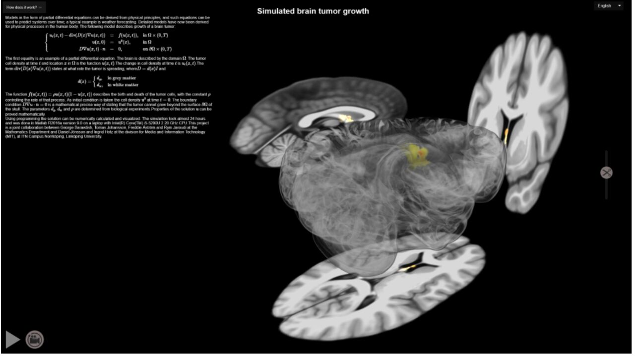 Scans of the human brain