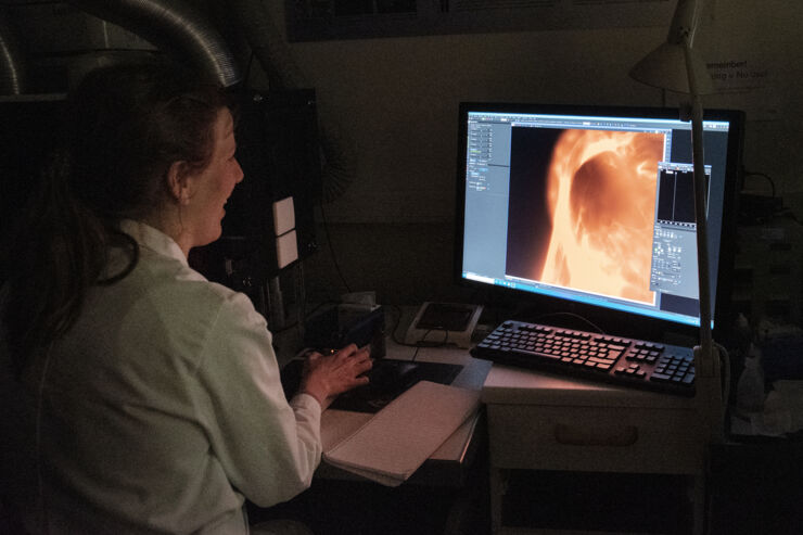 Reseacher looking av microscopic image on a computer screen.