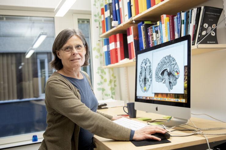 Maria Engström visar en bild av hjärnan på en dator.