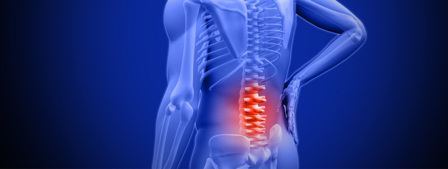 Blue-toned image showing the back of a human. The skeleton is visible (like a x-ray) and it is red around the lumbar spine.