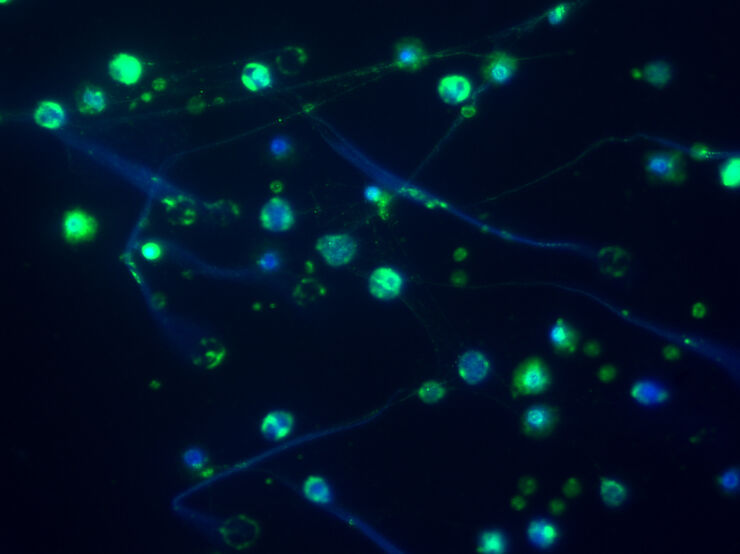 microscopy image showing DNA nets.