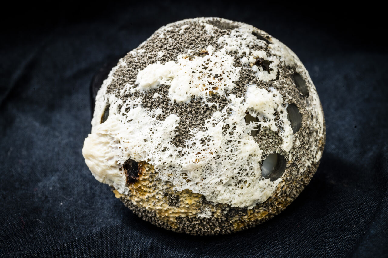 Hip prosthesis in titanium.