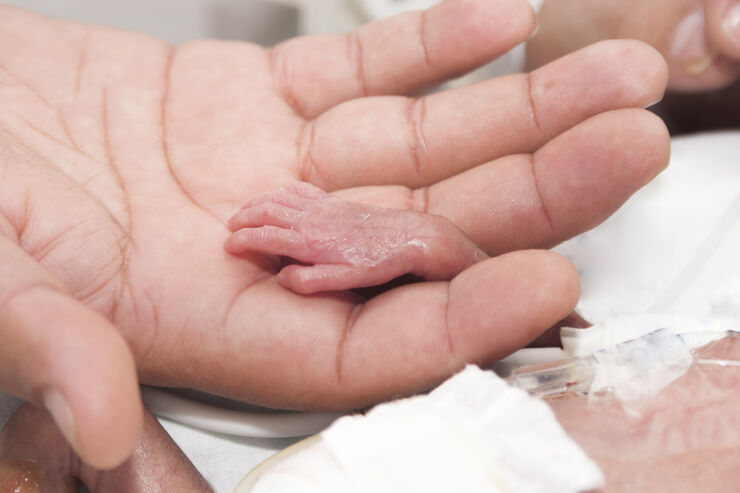 adult hand holding the hand of a prematurely born baby.