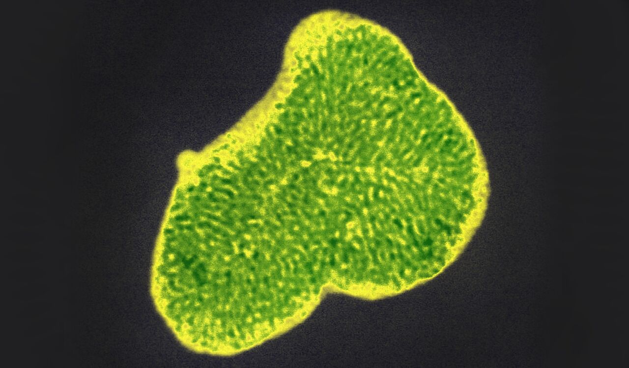 mikroskopbild meso nanostrukturella material.