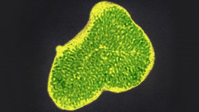 mikroskopbild meso nanostrukturerade material.