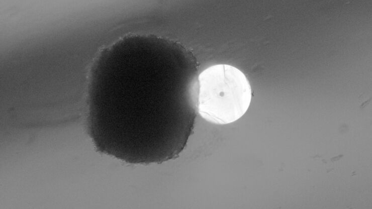 Cross section of the ion channel.