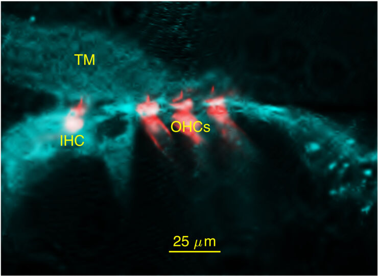 Confocal micrograph.