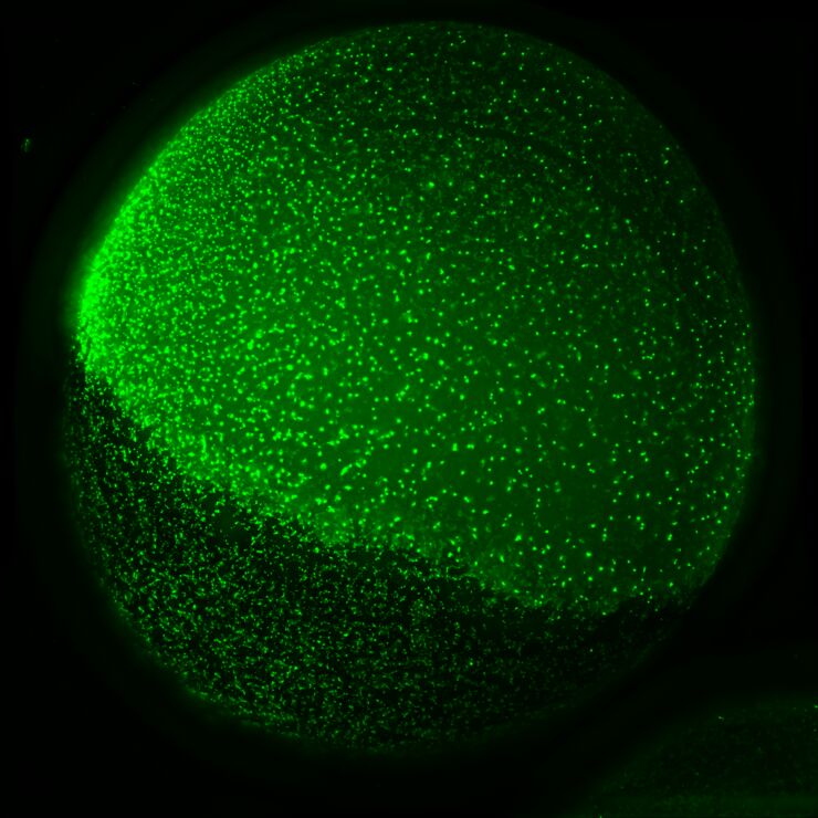 Oocyt (äggcell) från afrikansk klogroda som uttrycker mänskliga kaliumjonkanalsproteiner märkta med en grön fluorescerande molekyl, vilket gör att proteinerna kan synliggöras med mikroskoperingstekniker.