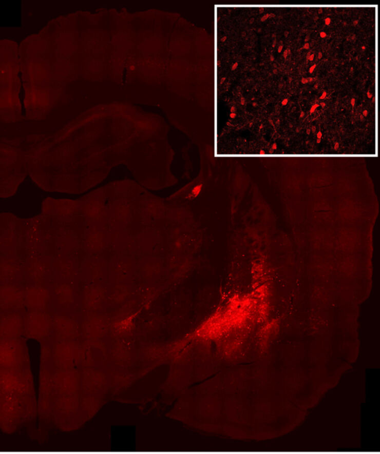 Microscope image of nerve cells stained red.