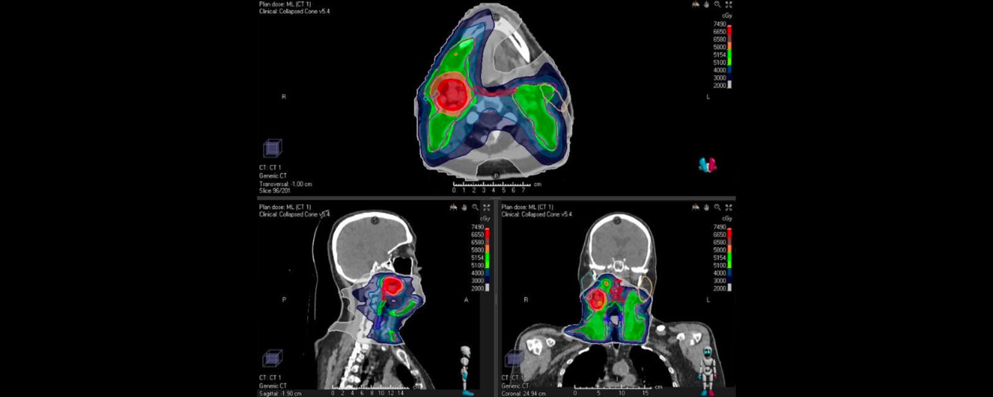 MRI photo of a human head.
