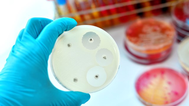 Antimicrobial susceptibility testing in petri dish.