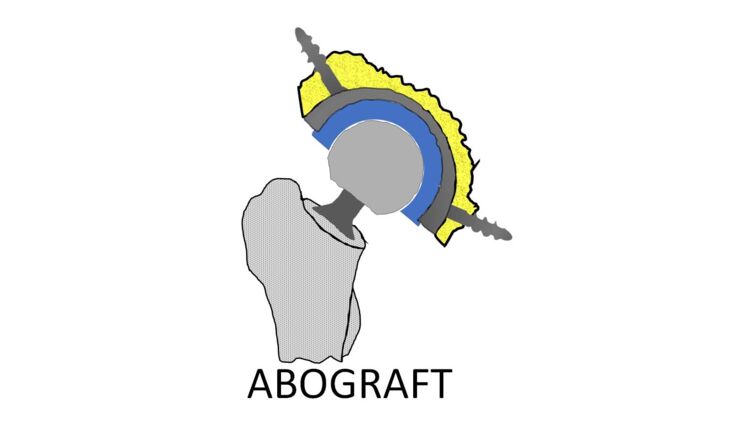 ABOGRAFT logotyp, ett forskningsprojekt inom forskargruppen PRIO.