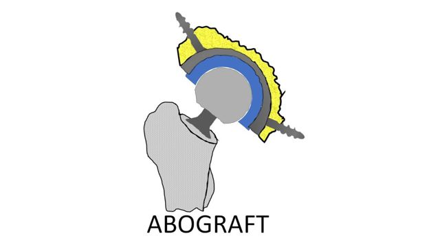 ABOGRAFT logotyp, ett forskningsprojekt inom forskargruppen PRIO.