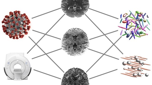 Bild med MR-bilder på en hjärna, på ett covid-19-virus och en MR-kamera. Bakgrunden är vit.
