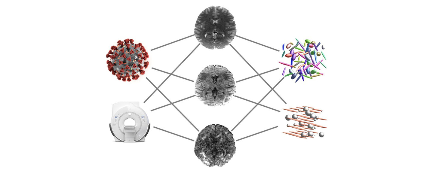 Photo with MRI of a human brain and a closeup of a covid-19 virus. The background is white.