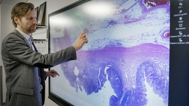 man pointing at a digital histology image on a big screen.