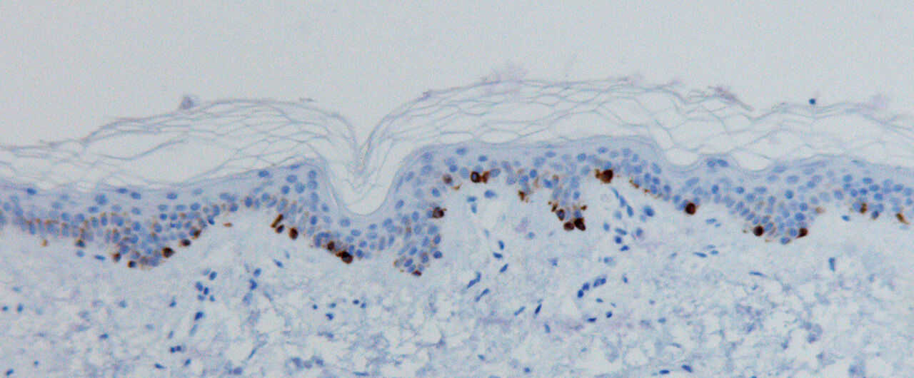 Image of skin in section.