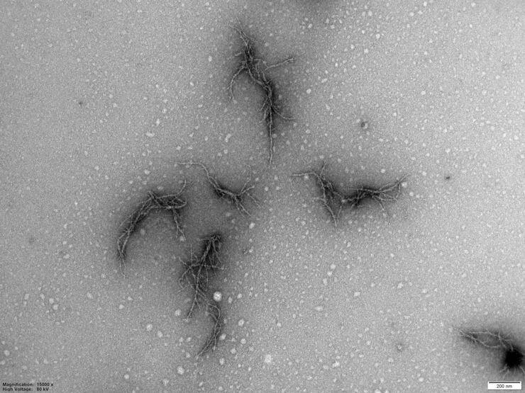 Electron microscopy image of amyloid formed by nail protein from coronavirus.